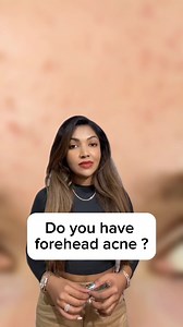 2.2K views · 40 reactions | Do you have forehead acne ? #acne #acnetreatment #foreheadacne #dandruff #dandrufftreatment #srilanka #colombo | Dr. Sarah Fazy / Dr. Cherry | Facebook