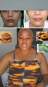10K views · 114 reactions | How to get half cast skin. #naturalremedies #NaturalBeauty #natural #NaturalSkincare #nature | Editorial Beauty556 | Facebook