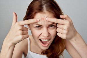 How to Remove a Pimple Fast and Without Leaving a Mark? Dermatologist Reveals the Safe Method!