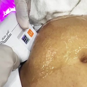 HIFU Fat Reduction and Skin Tightening Treatment 👩🏻 Tummy, Face, Double Chin, Arms 👩🏻 For appointments: Tariq Road Karachi: 0303-2227427, 0306-2227427, 021-34304442-3. DHA Karachi: 0321-1225719 021-38883275. #DrShaistaLodhi #ShaistaLodhi | The Aesthetics Clinic