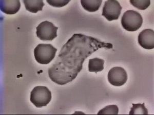 21K views · 217 reactions | Fascinating footage of a human white blood cell chasing a bacterium captured through a microscope. | Cardiophilia | Facebook