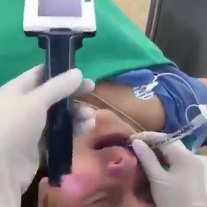 30 reactions · 16 shares | A new Technique for Insertion of an Endotracheal (ET) Tube | The Nursing Times | Facebook