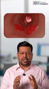 Understanding Cytoreductive Surgery | A Clear Guide for Patients & Caregivers