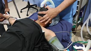 girl under anesthesia mask