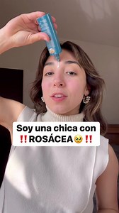 SOY UNA CHICA CON ROSACEA | Andrea Aldana