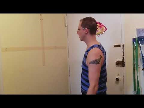 Week 6 SLAP Repair and Biceps Tenodesis Recovery