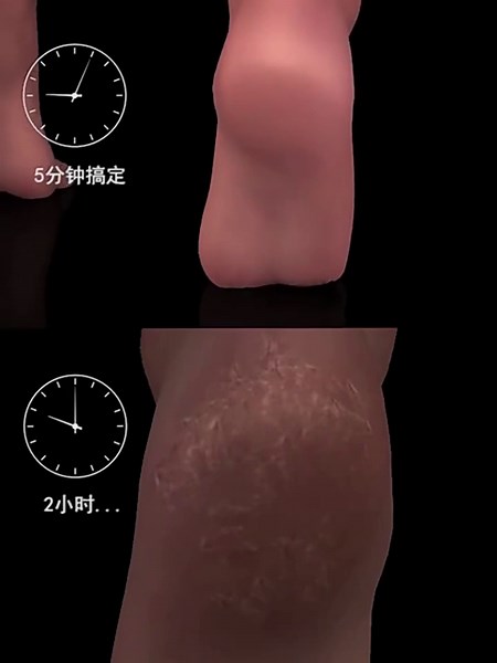 Stainless Steel Foot File Callus Dead Remover Heel Scraper and Shower Scrubber - Safely and painlessly removes calluses and Dry Skin from Heels (White)