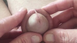 Foreskin and urethral dilation, urethral sounding