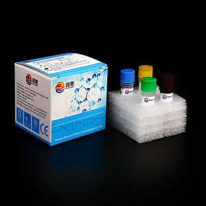 [Hot Item] Ivd Fluorescence PCR Detection Kit HIV-1 Nucleic Acid Rna Detection Kit