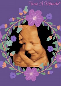 View A Miracle on Reels | Facebook