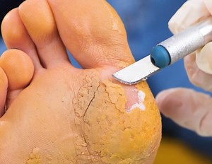 10K views · 20 reactions | Ultimate Foot Care Hacks for Happy, Healthy Feet! | Health is Wealth | Facebook