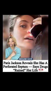 5.8K views · 90 reactions | Septal perforations, a hole in the wall...