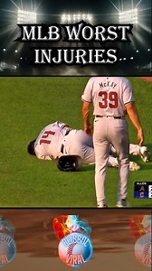 MLB Worst Injuries #baseballlife #mlb #baseball #beisbol | Beisbol Viral
