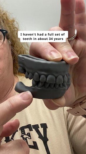 ✅ FSA & HSA Eligible ✅ 朗$299 for Top OR Bottom Veneers! Your New...