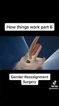 How things work | Gender reassignment surgery for male to female