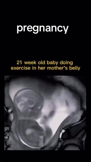 Human embryo development #embryo #embryology #medicine #medstudent #medical