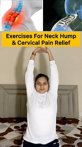 364K views · 3.5K reactions | Exercises For Neck Hump & Cervical Pain Relief Sarv Samridhi Yoga #neckpainrelief #neckhumpfix #cervical #cervicalpain #posturecorrection #yoga #exercise #fbreels #fbreelsvideo #viralreelschallenge #virals | Sarv Samridhi Yoga | Facebook
