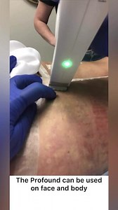 Be Profound - Tighten, Lift, and Smooth