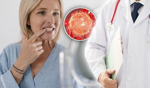 Mouth cancer: What are the causes and symptoms?