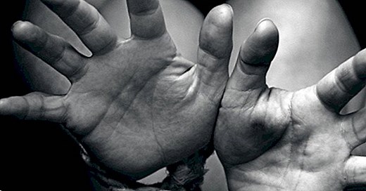 Lima syndrome: kidnappings turned into a delirium - yes, therapy helps!