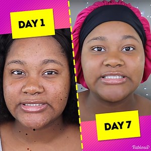 30K views · 114 reactions | She applied a turmeric mask for 7 straight days to fight pigmentation and pimples. | Tips & Tricks | Facebook