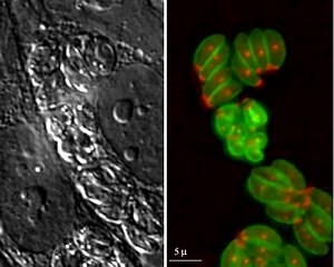 File:Cytoskeletal-Components-of-an-Invasion-Machine—The-Apical-Complex-of-Toxoplasma-gondii-ppat.0020013.sv002.ogv - Wikimedia Commons