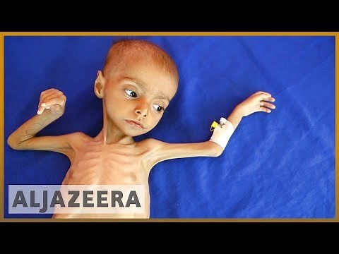 🇾🇪 19 million Yemeni children suffer malnutrition and illness l Al Jazeera English