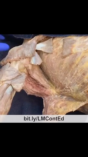 🔹 LearnMuscles.com 🔹 Excellence-in-education 🏅 🚨Take advantage of our Black Friday deal going on now! Get 25% off today - offer ends Nov. 30th at midnight. 🌟 Uncovering the Serratus Anterior - Cadaver Anatomy. ✅Cadaver labs are the best way to learn the architecture of the body, for muscles, to learn the attachments. 🔸This video shows the more superficial muscles that need to be removed or reflected away to uncover and visualize the serratus anterior. 🔸Context: the cadaver is supine and w