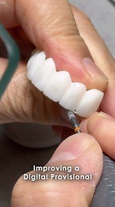 54K views · 55 reactions | Improving a Digital Provisional! Join our YouTube Membership or Patreon to see more! YouTube.com/LSK121 Patreon.com/LukeKahng #reels #reelsinstagram #reel #youtubemembership #patreon #membership #premiere #dental #dentalart #dentalreels #dentist #dentistry #DentalTech #dentaltechnician #DentalTechnology #video #videos #lsk121 #lukekahng | CEO Luke Kahng | Facebook