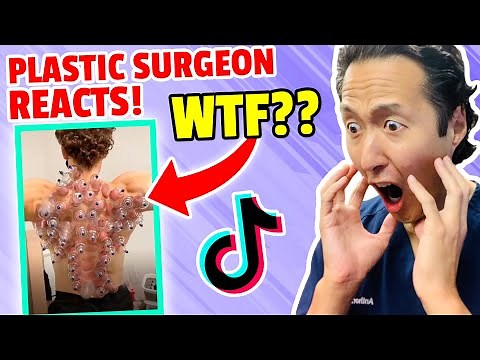 Plastic Surgeon Reacts to INSANE TikTok Videos!