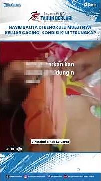 PILU! Tubuh dan Mulut Balita Asal Bengkulu Keluar Cacing, Dokter Ungkap Kondisnya Terkini