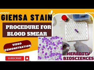 Giemsa Stain Procedure for Blood Smear ‪@hereditybioacademy7062‬
