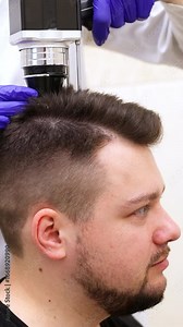 Computerized examination of the scalp and hair. A trichologist diagnoses the hair condition of a male patient in a modern center. A concept of advanced medical and cosmetic services.