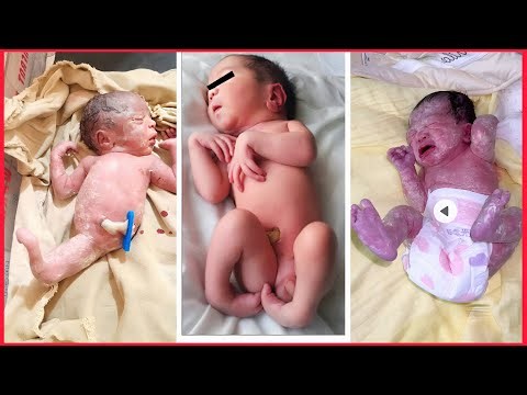 Newborn Baby First Moments | Feeding & Medical Care🥰🥰/#baby #cute #newbornbaby