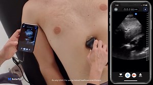 Get started with #ButterflyiQ! This video shows how to incorporate ultrasound into the evaluation of a patient in cardiac arrest. Watch more cardiac education videos: https://bit.ly/3GW46Sf #HeartMonth These videos, including all text and graphics, are for informational purposes only and are intended to show the potential uses of the Butterfly iQ. They are not a substitute for clinical training and experience. Clinicians are solely responsible for patient care and for exercising their independen