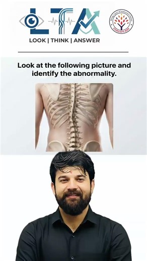 Identify Spinal Abnormality?🤔#nursingstudents #nursingexam #rrbexampreparation #norcet #staffnurse