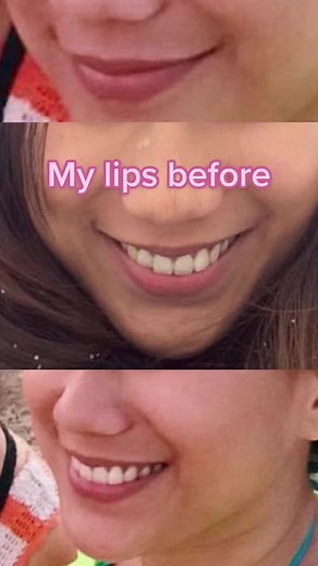 The Perfect Pout PH on TikTok