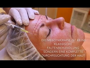 Mesotherapie mit Hyaluronsäure - Behandlung Vorher Nachher