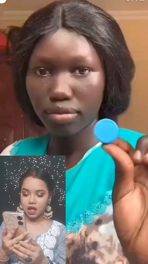 Viral dimple hack 😲🤯 #viral #hack #makeup #Dimples #FacebookReelsContest #facebookvideo #facebookshortsvideo #viralshort | Anisha Das