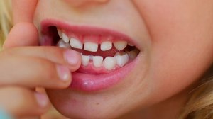 Child Shows Her First Loose Tooth Stock Footage Video (100% Royalty-free) 1050926734 | Shutterstock