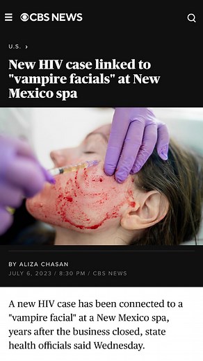  The safety of vampire facials raises some serious questions. Dr. Rohrich and Dr. Adams discuss the potentials dangers and provide their input on this recent story!  @rod.rohrich @adamsplasticsurgery #vampirefacials #cbsnews #antiage #medspa #cosmetic #newmexico #plasticsurgeons | The Plastic Surgery Channel | Facebook