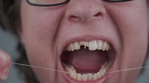 Une femme adulte ayant une dent : vidéo de stock (100 % libre de droit) 1071156727 | Shutterstock