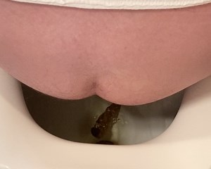 Slow Release of Logs