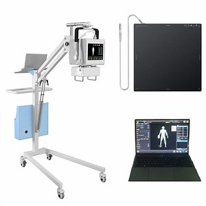 [Hot Item] Portable Digital X Ray Machine Medical Dr X-ray Machine for Human & Veterinary Radiography Imagine
