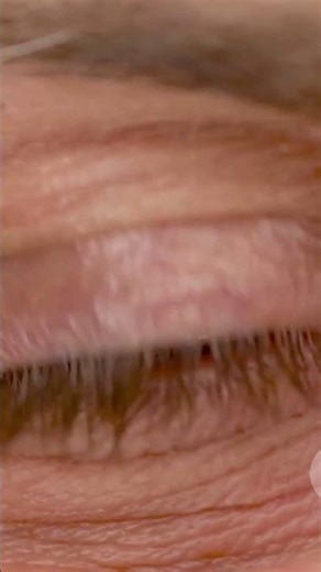 Rare Body Feature You Might Have!