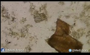 11K views · 281 reactions | stool sample diagnosis ???  | المكتبة الطبية MedicalLibrary | Facebook