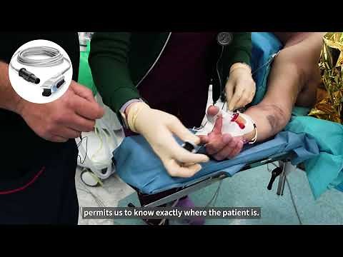 Surgical Plethysmographic Index (SPI) monitoring