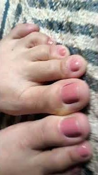 TAG DOS PÉS - louco/crazy feet tag #foot #feet #pe