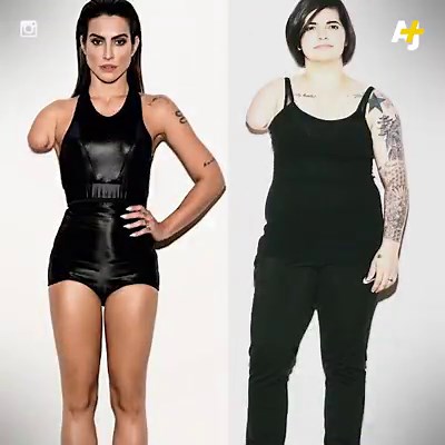 Instead of using any of the 4,000 Paralympic athletes, Vogue decided to photoshop able-bodied models into amputees to promote them. | AJ