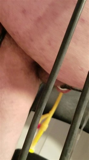 Fun with catheter and vibe plug